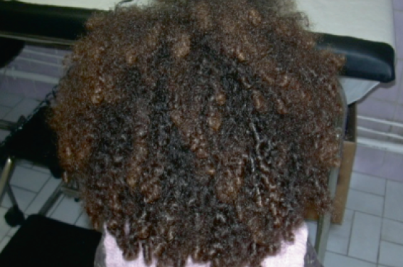 Cosmétologie des cheveux chez l’enfant noir Cosmétologie des cheveux chez l’enfant noir