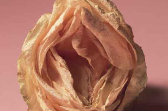 Pathologie vulvaire pédiatrique Pathologie vulvaire pédiatrique